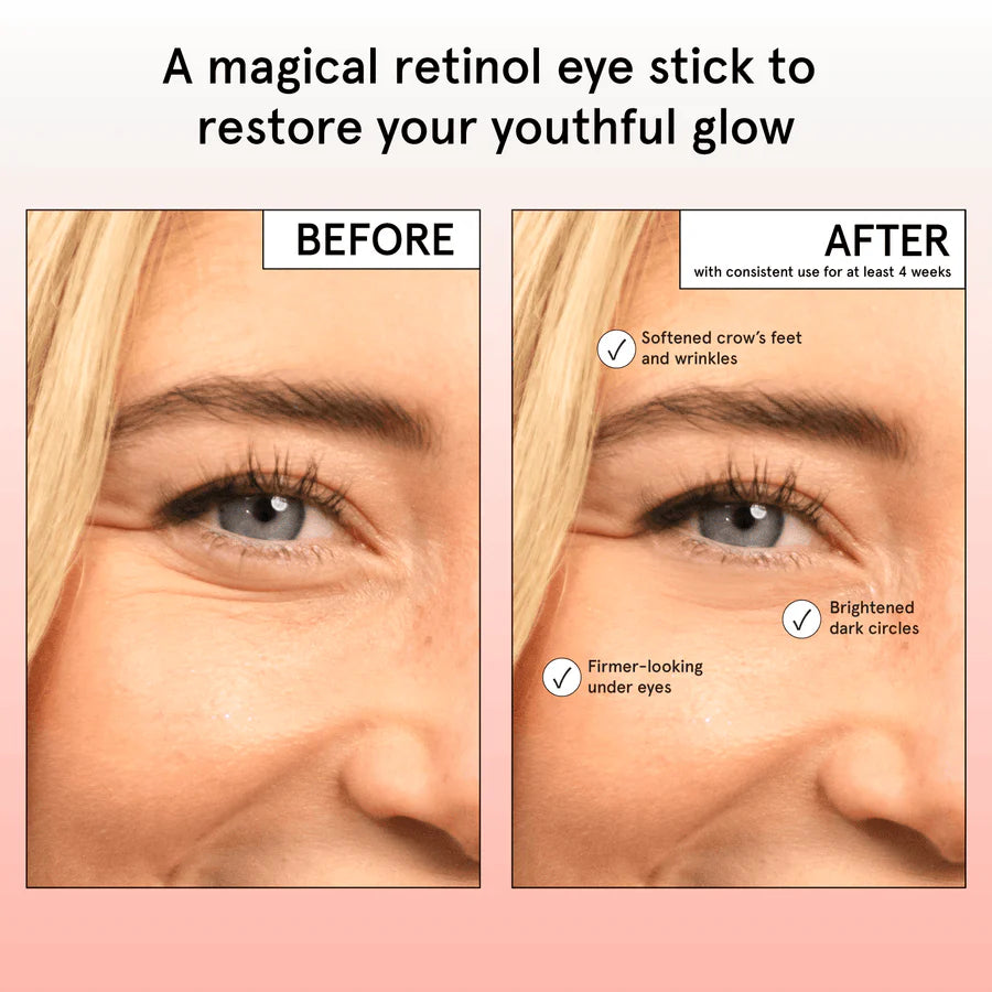 Restoring Eye Balm